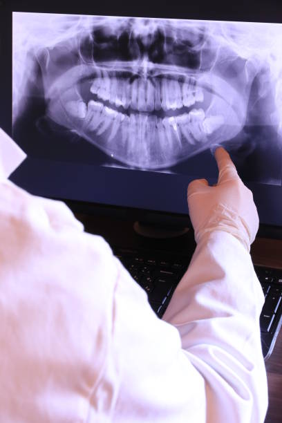 Best Emergency Treatment for Oral Infections in Tipton, IN